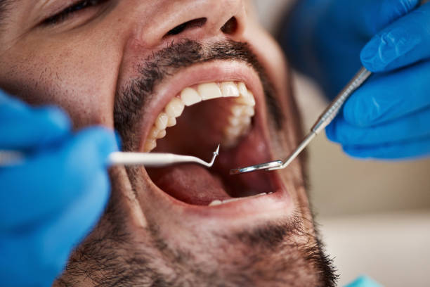 Best Cracked Tooth Emergency Dentist  in Highland Park, TX